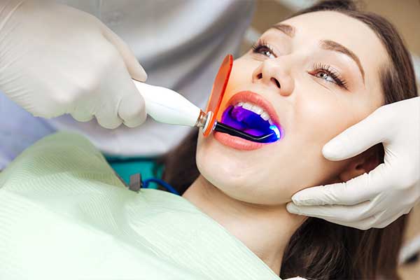 Dental-Fissure-Sealants-Ferrari-Dental-Care